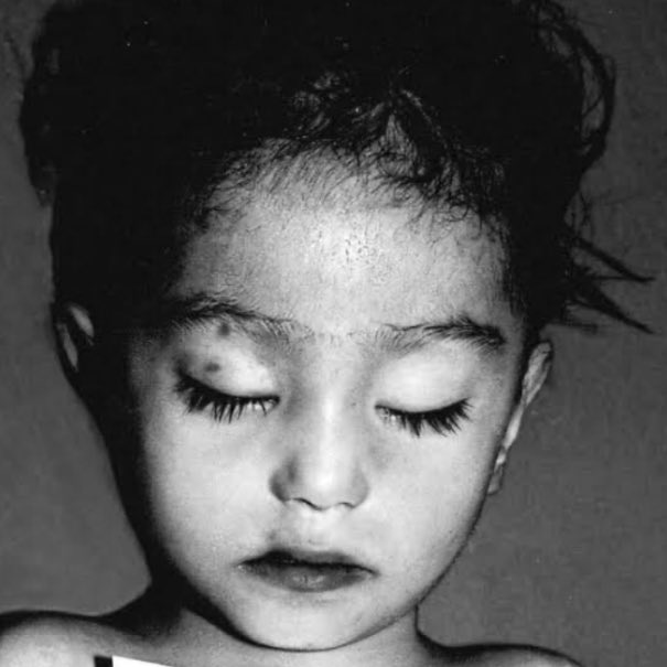 yohaliresendiz's tweet photo. Querida “Ángela” aún sigo buscando a tu familia… ¿la reconoces? 

La primera foto de izquierda a derecha es el rostro que compartió irresponsablemente a los medios de comunicación, la @FiscaliaCDMX (en el 2015) para que la sociedad pudiera reconocer a la pequeña que había sido encontrada sin vida dentro de una maleta en la Col. Juárez #CDMX

Luego de iniciar mi investigación del caso logré obtener la foto del rostro real de la pequeña (segunda foto de izquierda a derecha) que nada tiene que ver en características físicas por el retrato compartido por las autoridades. 

Hasta hoy mi conclusión es que nadie reconoció a la menor porque la Fiscalía en CDMX compartió un rostro que nadie pudo reconocer y que la autoridad a pesar de que lo señalé, jamás quiso enmendar el error. 

Sin embargo, a 9 años, continuó buscando pistas sobre la pequeña “Ángela” 

Si tienes información escríbeme a periodismoatodaprueba@gmail.com 

Aquí la actualización del caso a 9 años
con @PamCerdeira 
⬇️

https://t.co/PmaHMm9xNf