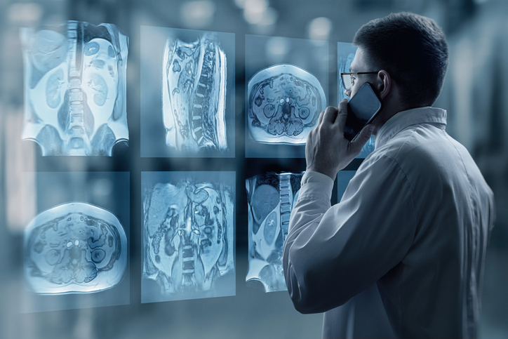 Unlock the Power of Radiological Testing in Clinical Trials!🔍 CAP detects fatty liver, but MRI-PDFF is a game-changer for tracking changes over time. 🔬Dive deeper into imaging strategies for liver fibrosis detection and more in this abstract: pubmed.ncbi.nlm.nih.gov/37024213 #UCSDACTRI