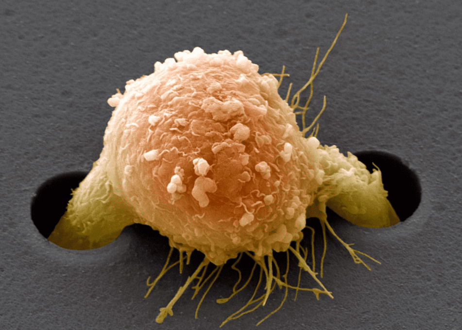 MultiplatformAI's tweet photo. AI surpassed pathologists in identifying the origins of metastatic cancer cells, aiding diagnosis and treatment

#AI #AItools #artificialintelligence #cancerdiagnosis #cancermanagementstrategies #clinicalsettings #deeplearningalgorithm

https://t.co/BOBAvLV3U5 https://t.co/2sZ40hxMCh
