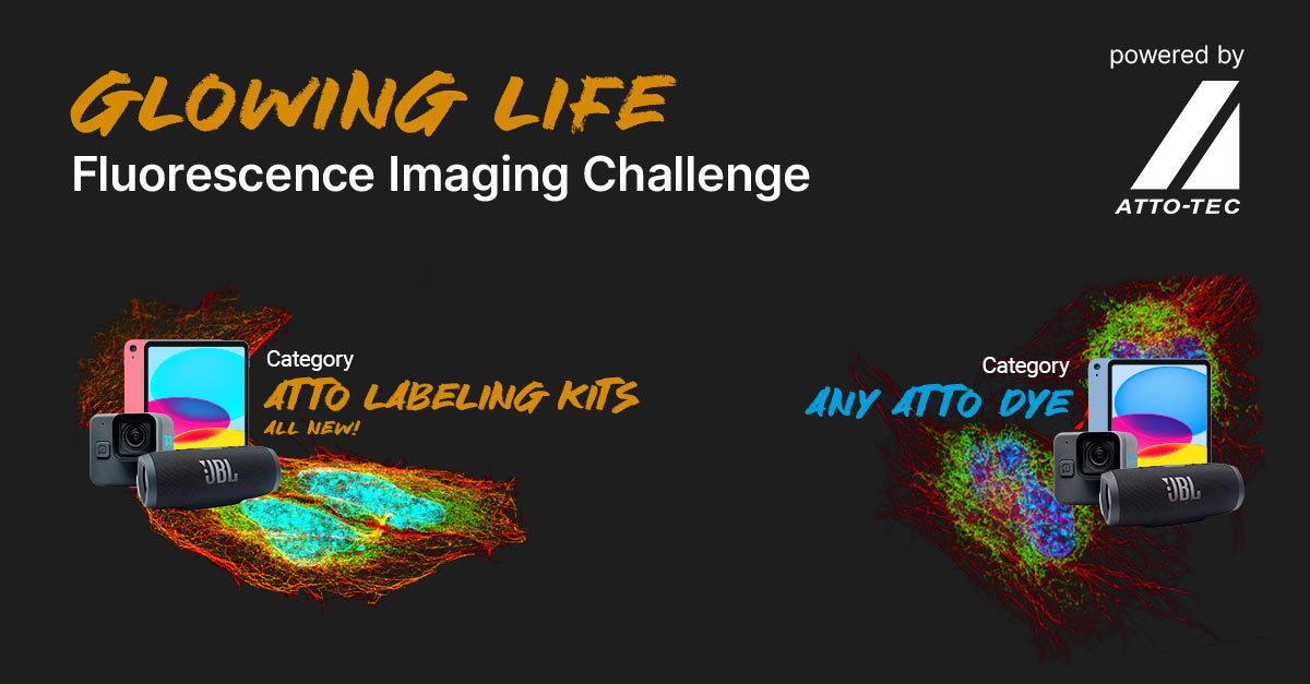 Join the #GlowingLifeChallenge in 2 categories! To elevate your odds, enter in our niche opportunity “ATTO Labeling Kits”, grab our Labeling Kit here atto-tec.com/atto-antibody-… and compete with your masterpiece. challenge.atto-tec.com

#Fluorescence #ScienceArt