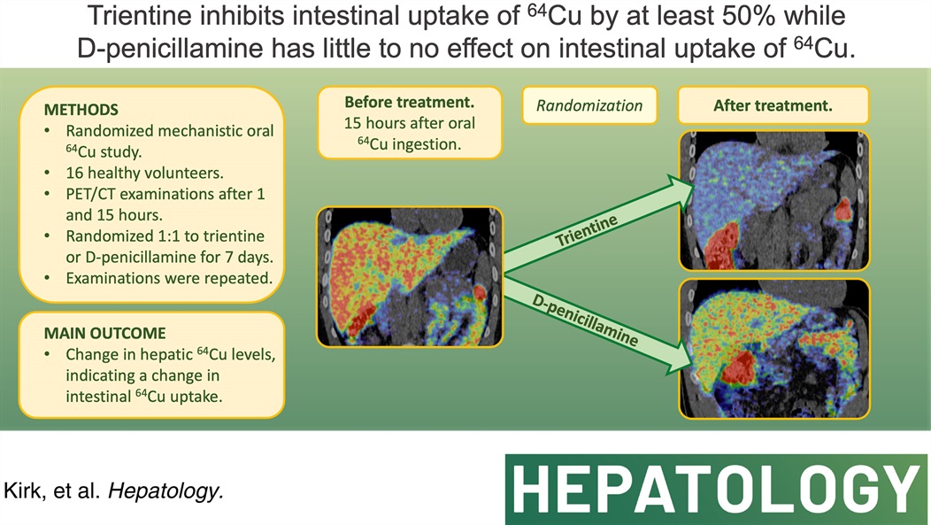 Trientine and Penicillamine on copper uptake: 🔸Oral 64-Cu PET/CT 🔸TRI reduced 64-Cu intestinal uptake 50%! 🔸Similar to Zinc [Munk et al] 🔸Time for separate 24H-urine copper targets for TRI monitoring? OA: t.ly/PDFxQ @AarhusUni @HepGas @HEP_Journal #livertwitter