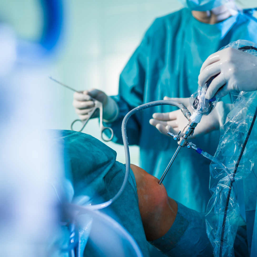 LASportsOrthoMD's tweet photo. This study aims to shed light on postoperative pain and opioid use differences between #ACLrepair and #ACReconstruction. Could #ACL repair be a viable option without the need for long-acting #nerveblocks? Join us on this research journey! https://t.co/Mz1vX2fKsc https://t.co/kLka3mMsjM