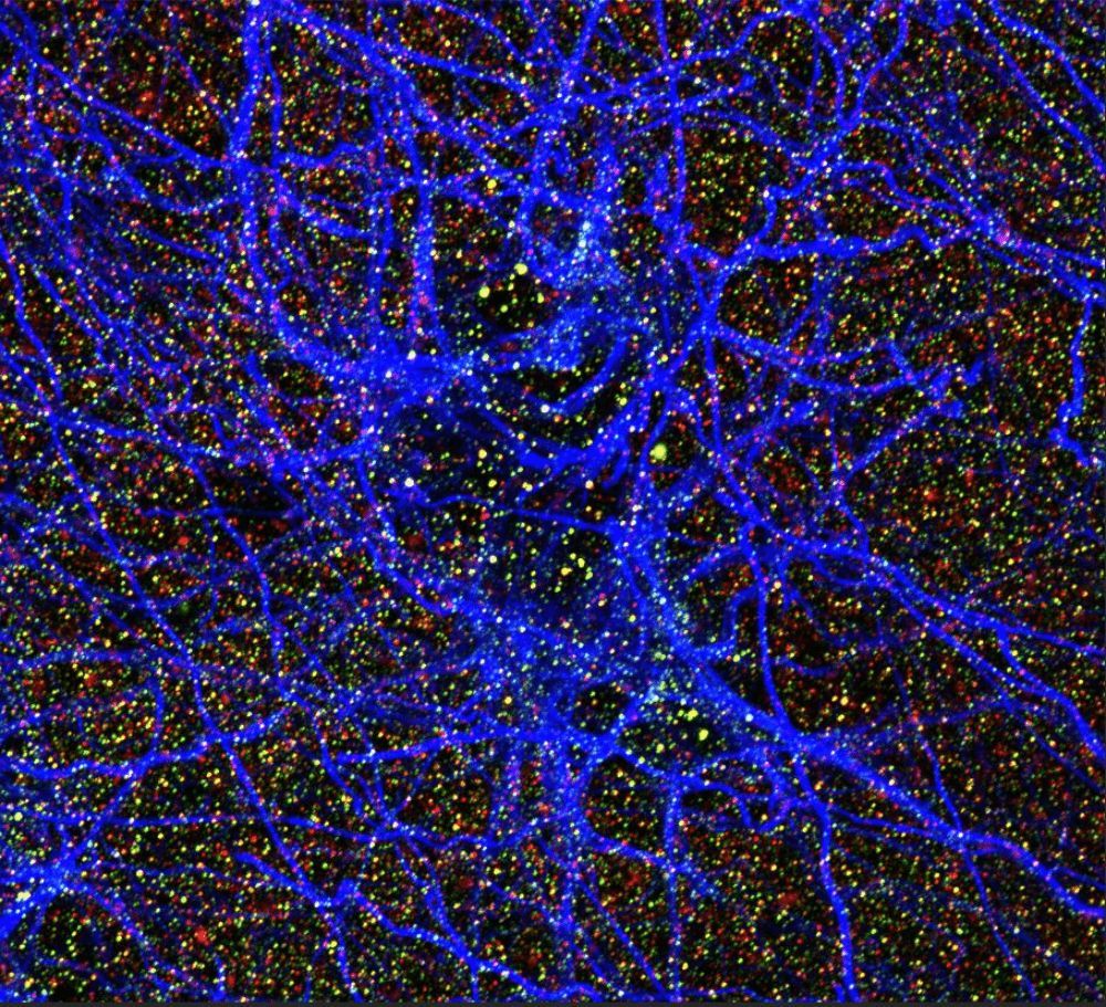 This week's #MGRIimageoftheweek is The Universe Inside Your Brain, submitted by C. Zachary Klein from @MGHNeurology! In this image, we see an astrocyte interacting with synapses in the visual cortex of a human brain. Read more: mgriblog.org/2023/11/13/vot…