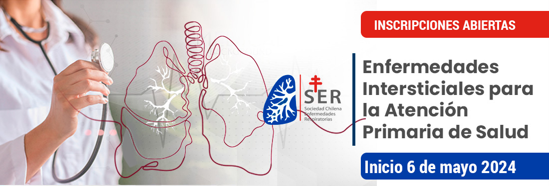 SerChile tweet media