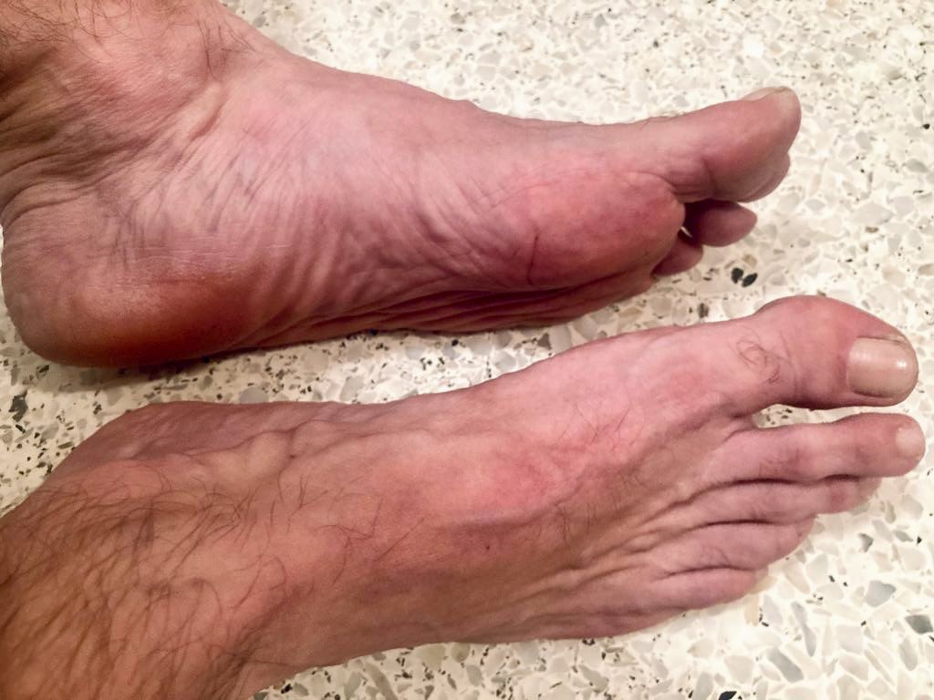 manfootfresh's tweet photo. #malebarefeet #menfeet
#menfeetsole #piesmasculinos
#piesdehombres #gayfeet #maletoes #bigmanfoot https://t.co/cySXG15kEm
