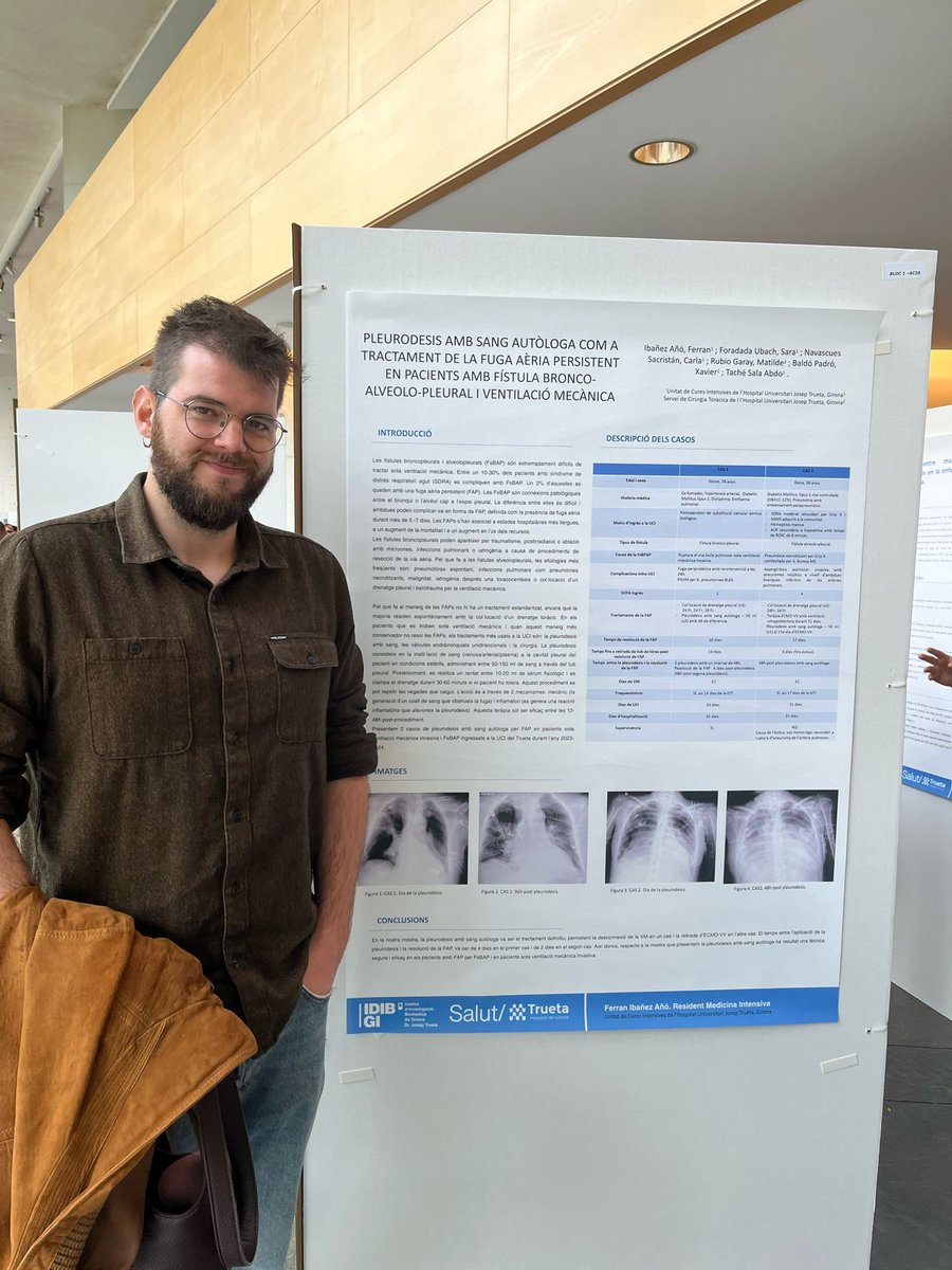 UCI Girona (@ucigirona) on Twitter photo Els residents de la <a href="/UCIGirona/">UCI Girona</a> han tingut una gran participació a la III Jornada Gironina de #Recerca per Residents de l'<a href="/idibgi/">IDIBGI Institut d'Investigació Biomèdica de Girona</a> i amb premi a la millor comunicació!! Molt orgullosos de vosaltres! Els residents de la <a href="/UCIGirona/">UCI Girona</a> han tingut una gran participació a la III Jornada Gironina de #Recerca per Residents de l'<a href="/idibgi/">IDIBGI Institut d'Investigació Biomèdica de Girona</a> i amb premi a la millor comunicació!! Molt orgullosos de vosaltres!