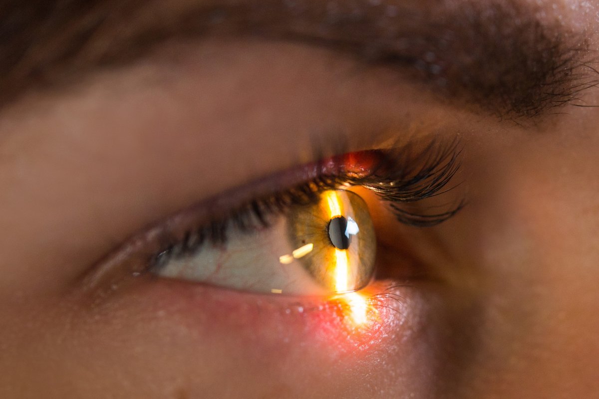 RCSEd's tweet photo. We are thrilled to announce that applications are now open for the newly restructured Fellowship of Ophthalmology - Written Component Examination.

The closing date for applications is Friday 10 May 2024. Find out more: https://t.co/M9MtC68aKq https://t.co/Wx8zlFQOua