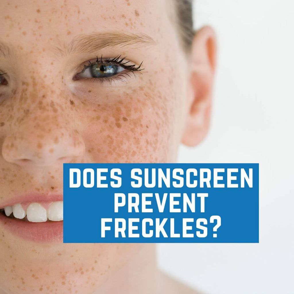 Does #Sunscreen Prevent #Freckles? buff.ly/442KObf