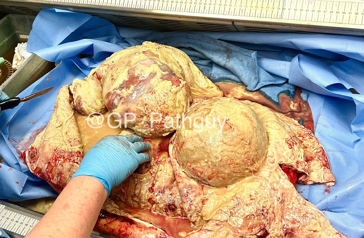 Glenn Murray tweet media