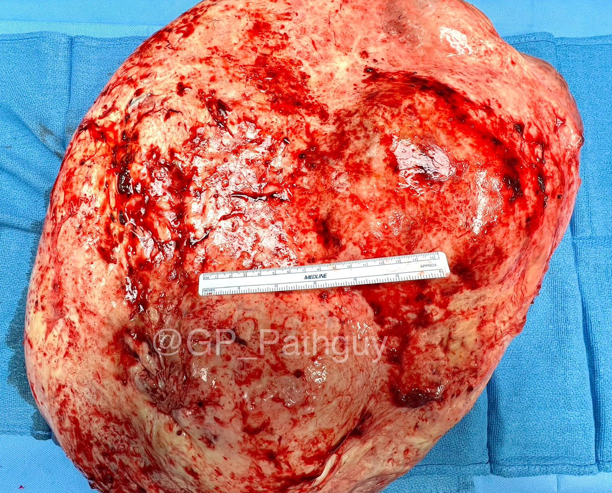 Glenn Murray tweet media