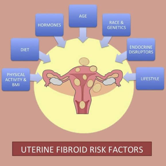 #HealthProgram | #Wednesday8pm 

We are discussing about #UterineFibroids..

Below are risk factors , we are going live.
Do you have any questions? Suggestions or opinions? 

Share them in the comments 

@guguddetvuganda @Amref_Uganda @ACCESS_UG @rkalyes1 @SabrinaKitaka