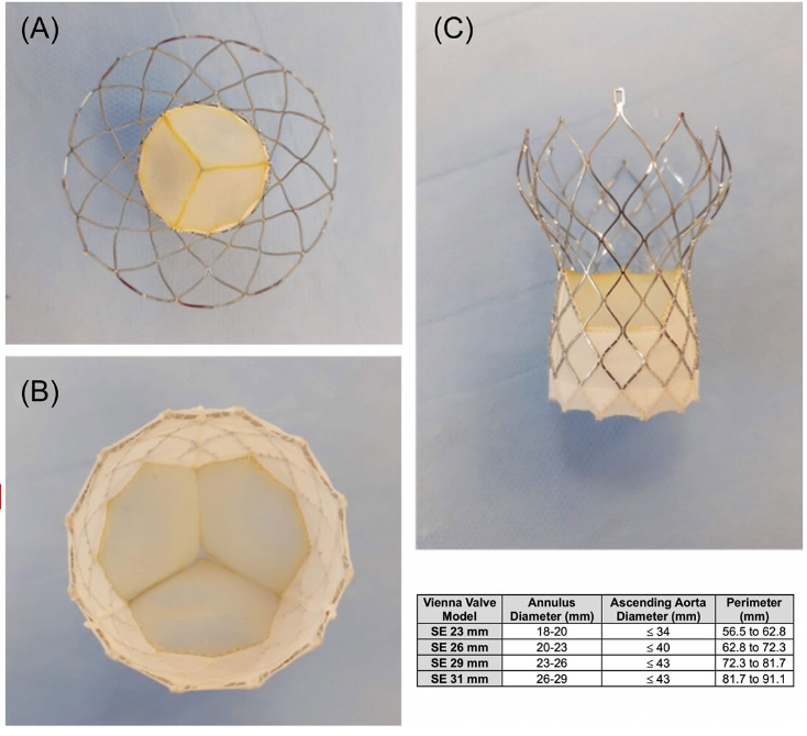 The VIVA first‐in‐human feasibility study evaluated the Vienna device in 10 patients with severe aortic stenosis, suggesting that this device may be appealing to streamline TAVI procedures and potentially lower healthcare costs by reducing resource, equipment needs, and…