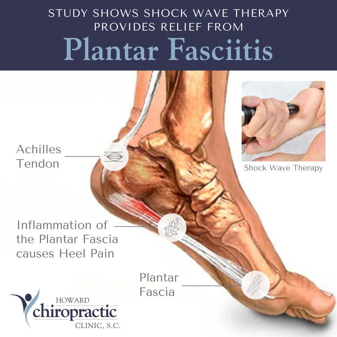 Get relief from PLANTAR FASCIITIS 👟 with Shock Wave Therapy! Studies show it reduces pain and improves functionality. Learn more at buff.ly/3PZmFMB or call 920-434-2221 to schedule. #plantarfasciitis