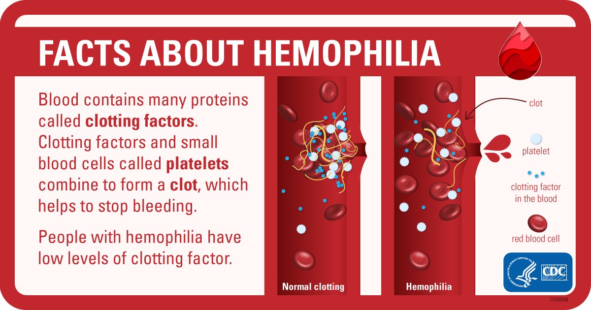 Today is #WorldHemophiliaDay! #Hemophilia is a #BleedingDisorder in which the blood does not clot properly, making it harder for bleeding to stop. Help raise awareness by retweeting if you or a loved one is living with hemophilia: bit.ly/3M6E0Pp @wfhemophilia #WHD2024
