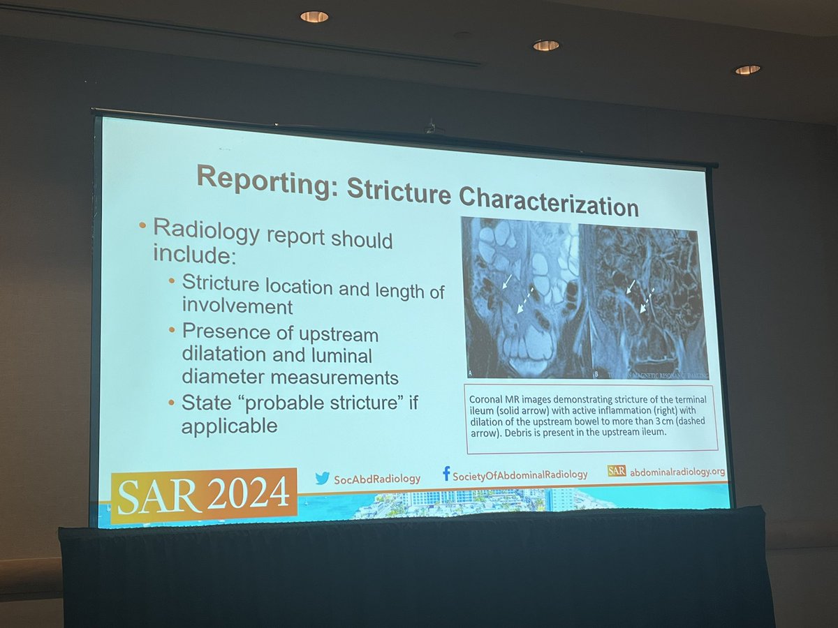 Structured reporting of strictures in Crohn’s is highly important! Trust @JoeGrajo to remind us of that! #SAR24 📝 @SocietyAbdRad