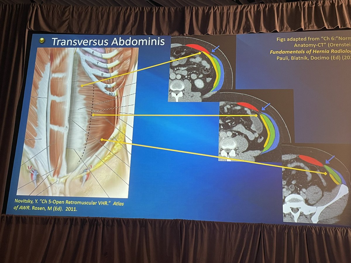 Herniadoc's tweet photo. What a great series of pics by @OrensteinSean 

I really enjoyed his talk. 

Did I mention how much I enjoyed hernia radiology? It’s so important for good surgical planning. 

#SAGES2024 @SAGES_Updates https://t.co/mCaNyt7EFp