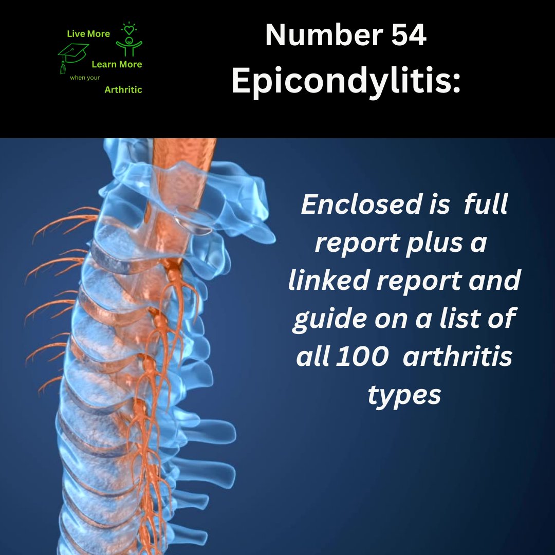 The Tale of Epicondylitis: A Real Pain in the Elbow

Click here to see the list of 100 different types of arthritis in order of occurrence

#arthritis
#arthritic
#arthriticpain
#arthriticpainrelief
#arthritiscare
#arthritisawareness
#arthritisremission

arthriticare.co/epicondylitis-…