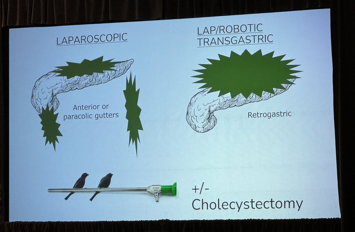 🐦‍⬛ Two Birds, One Scope! 🐦‍⬛

@MonicaDuaMD presents on a challenging operative dilemma: gallstone pancreatitis - when to take out the gallbladder? Lap Transgastric Necrosectomy is safe, efficient, and durable and often can include cholecystectomy in select patients!
