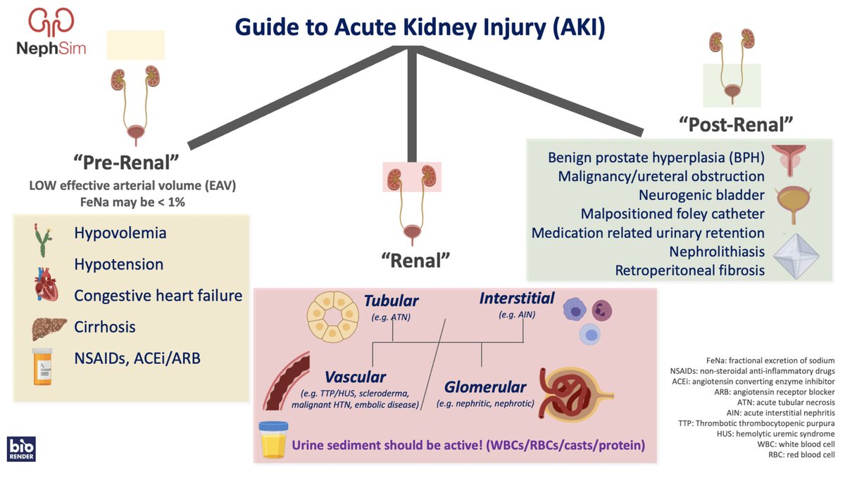 A guide to acute kidney injury #AKI (Designed to be simplistic & an initial approach) nephsim.com/image-gallery/… #Nephrology #FOAMed #MedEd