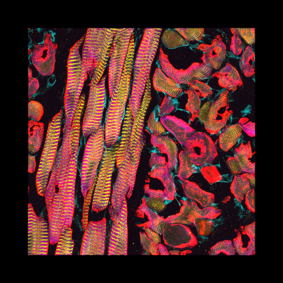 This April, Clemson hosted its annual Science as Art gallery, founded and co-directed by ESED's own Lisa Benson. 

This year, ESED student Rhonda Powell won 4th place for "Speak Now," her light microscopy image of a sheep tongue. Congratulations, Rhonda!

linkedin.com/posts/clemson-…