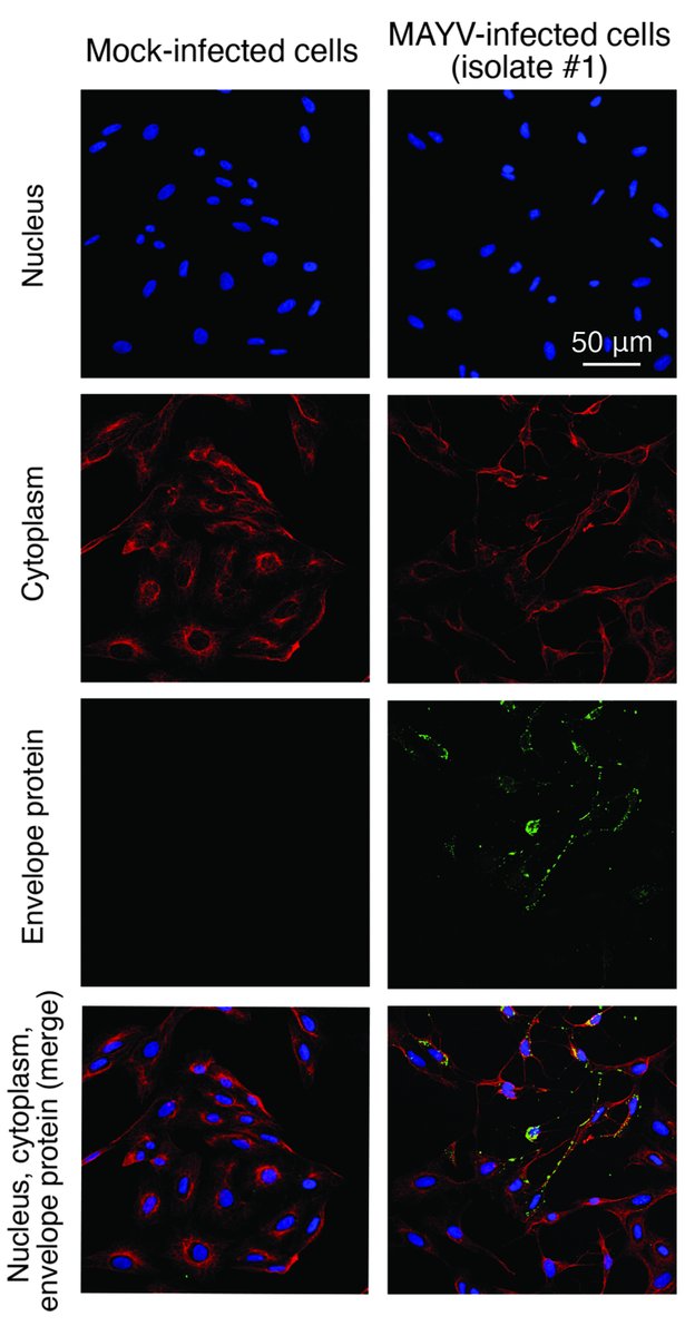 wmarciels's tweet photo. Mayaro virus found in 3.4% of febrile patients in Roraima, Brazil (2018-2021)! In our study at @EIDjournal  we detected, sequenced, and isolated the Mayaro virus &amp; confirmed genotype D.

Led by Júlia Forato and @LeveUnicamp team. 🦟🦠🇧🇷

Read: https://t.co/2Fjdg6dQvT https://t.co/BlAccRyeZ2