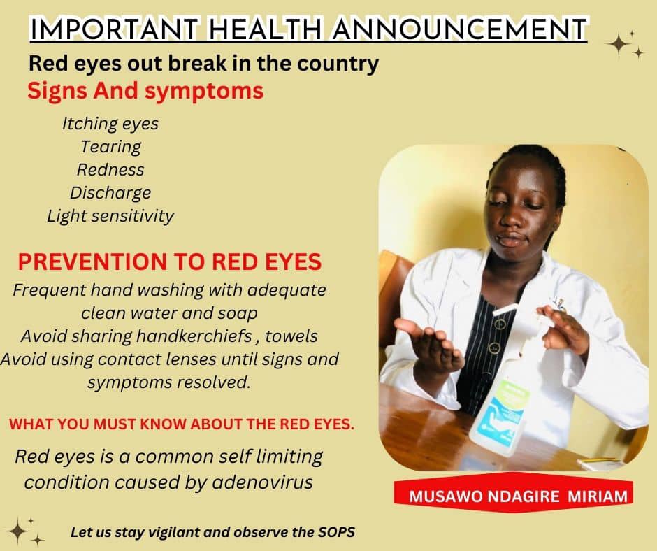 The #Redeyes is on arise and highly contagious 
Follow the preventive measures to protect yourself and and others 🙏

In case of any infected people refer them to the Health Centers for medical assistance 🤝