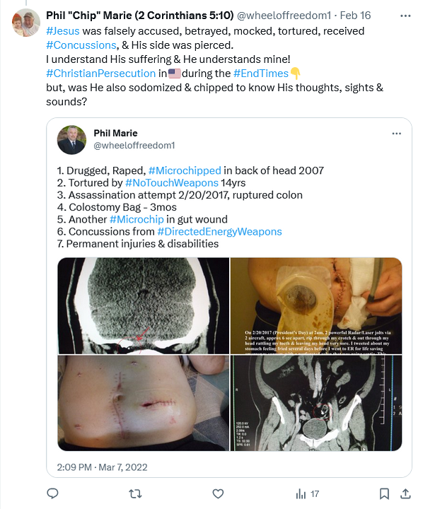wheeloffreedom1's tweet photo. ALL OF HEAVEN is watching☁️👁️👁️☁️ this evil #BiochipTerrorism!
#Jesus is with me &amp; He knows the secrets of every person involved!
I'm just waiting for the POWERS OF HEAVEN to end this evil!
GOD WILL NOT BE MOCKED!🔥  
I trust that it will get ugly for many &amp; quickly!
#LastDays⌛️ https://t.co/c21cahFGBm