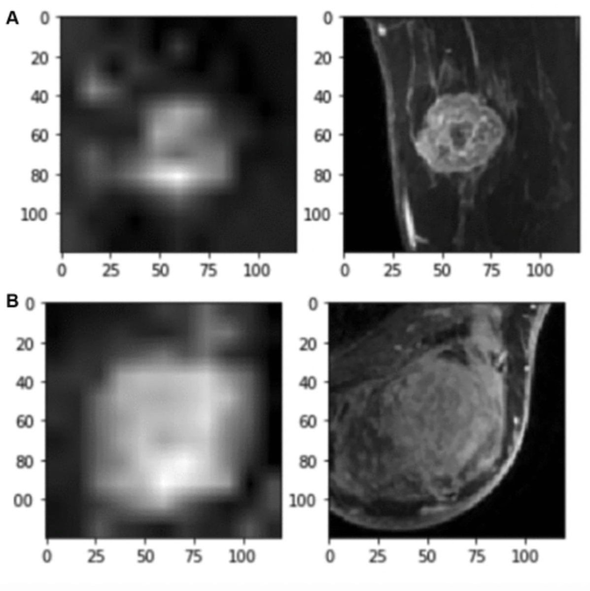 . #MRI Based #AI Model Shows Promise in Predicting Lymph Node Metastasis with #BreastCancer diagnosticimaging.com/view/mri-based… @ACRRFS @ACRYPS @RadiologyACR @ARRS_Radiology @CanadaSBI @SBIRFS @YaleRadiology @UABRadiology @UMichRadiology @UChicagoRADS @TulaneRadiology #radiology #RadRes