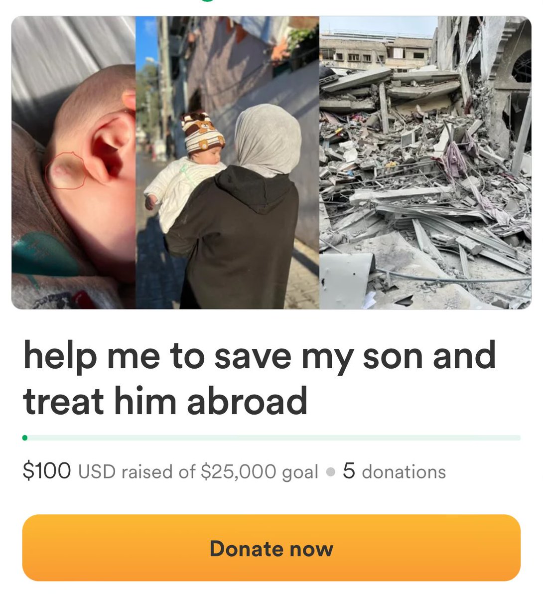 This family is so far from their goal, please donate if you’re able! Their son needs medical treatment!