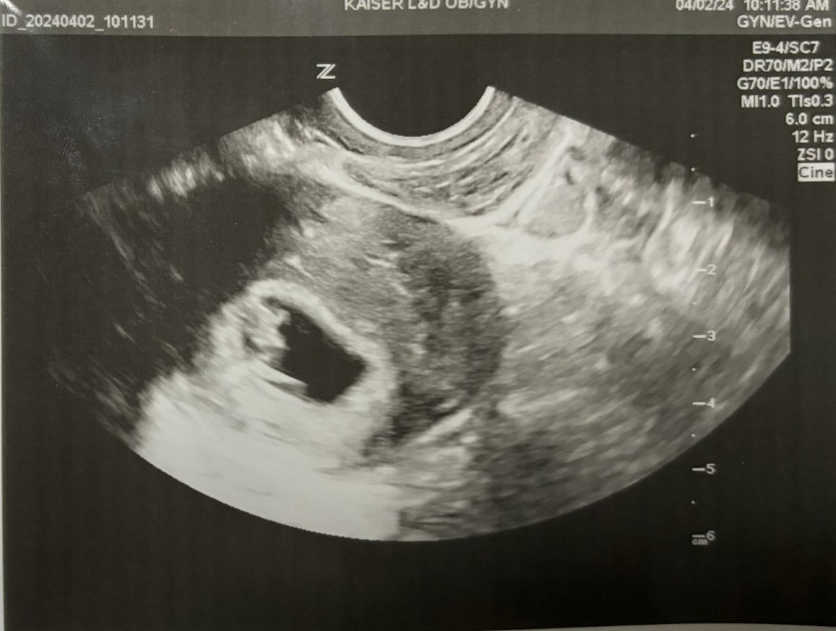 Baby on the way💫 November 2024 #pregnancy #gamingmom #momtobe #baby