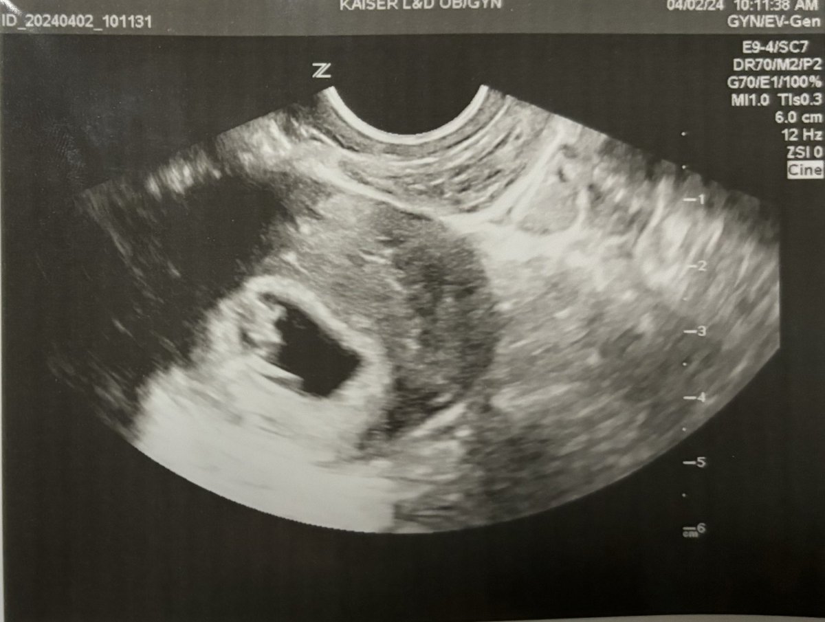 stinkiieplays's tweet photo. Baby on the way💫 November 2024 #pregnancy #gamingmom #momtobe #baby https://t.co/yUo4KNRtgH