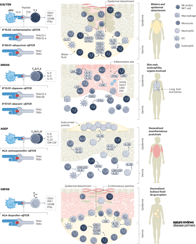 Our NEW Primer on Severe cutaneous adverse reactions is live today! By Hung, Mockenhaupt, @KimberlyBlumen1, Abe, Ueta, Ingen-Housz-Oro, Phillips & Chung. Check it out here: go.nature.com/3UxTT8C