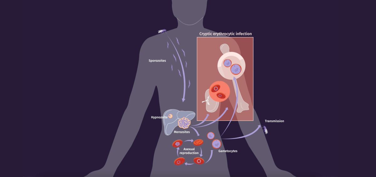 GTRecerca's tweet image. 🆕 Plasmodium vivax, a Human Malaria Parasite Resilient to Elimination

Carmen Fernández Becerra and Hernando del Portillo, researchers at @ISGLOBALorg and IGTP @PvrexLab, present recent scientific data on this &quot;forgotten&quot; parasite

Read more 👉🏼 bit.ly/WDMalaria_Plas…