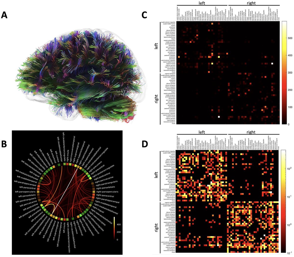 New paper in Imaging Neuroscience by Chuan Huang, Benjamin J. Luft, et al: Graph theory-based analysis reveals neural anatomical network alterations in chronic post-traumatic stress disorder doi.org/10.1162/imag_a…