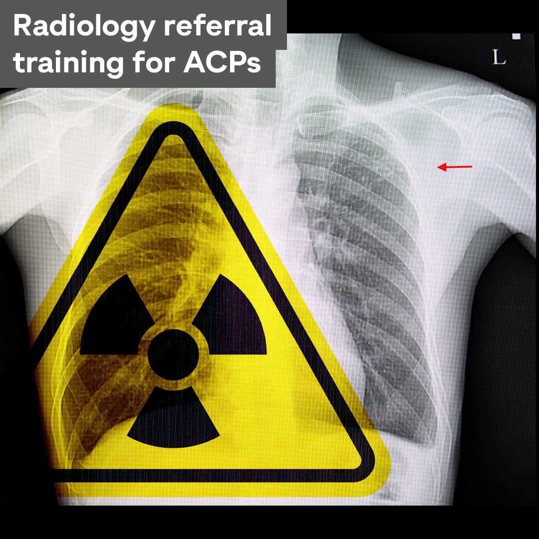 Are you a qualified #AdvancedClinicalPractitioner (ACP) requiring access to radiology imaging at Nottingham University Hospitals? Our next training session for chest, upper & lower limb x-ray requests will be 4 June (12.30-15.30) Register interest at > bit.ly/3UtoNPo