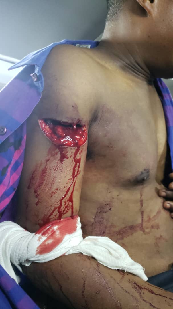 Byebye_M23's tweet photo. voilà comment les éléments M23 RDF viennent de blesser Mr Fikiri à Kalengera par la machette.
@michombero @IsralMutombo11 @DenisMukwege https://t.co/yjcY5zwsSr