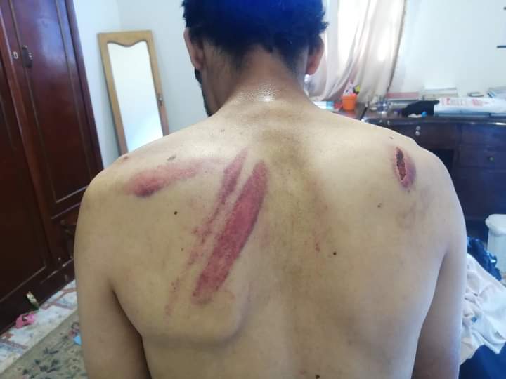 وغير قادر عن الدفاع عن نفسه المجرم دا لازم يتحاسب لأنه لو انساب كدا هيعمل ف غيره وف غيره كتير احنا معرفناش أنه حصل فيه حاجه غير واحنا بنغيرله هدومه لأن اسامه مبيعرفش يعبر عن ايه الل حصله دا ضهر اسامه واحنا بنغيرله بعد يومين من الجريمه