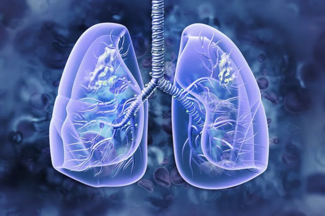Busquem infermer/a per fer recerca en Malalties Respiratòries (#MPOC, #Bronquiectasies) a <a href="/hospitalclinic/">Hospital Clínic</a> <a href="/idibaps/">IDIBAPS</a>. S’ofereix contracte a temps complert. Més info 👉
clinicbarcelona.org/uploads/media/…
<a href="/COIBarcelona/">Col·legi d'Infermeres i Infermers de BCN (COIB)</a>  <a href="/faner_rosa/">Rosa Faner</a>