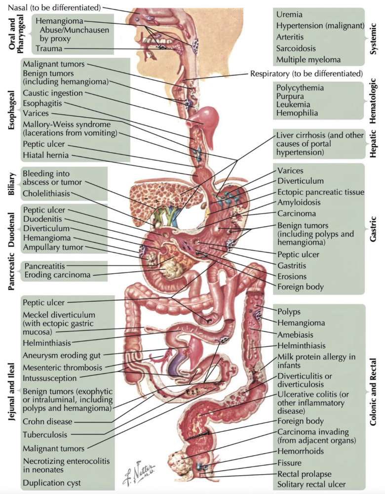 Diseases of digestive tract

#MedEd #MedX #GITwitter #digestive