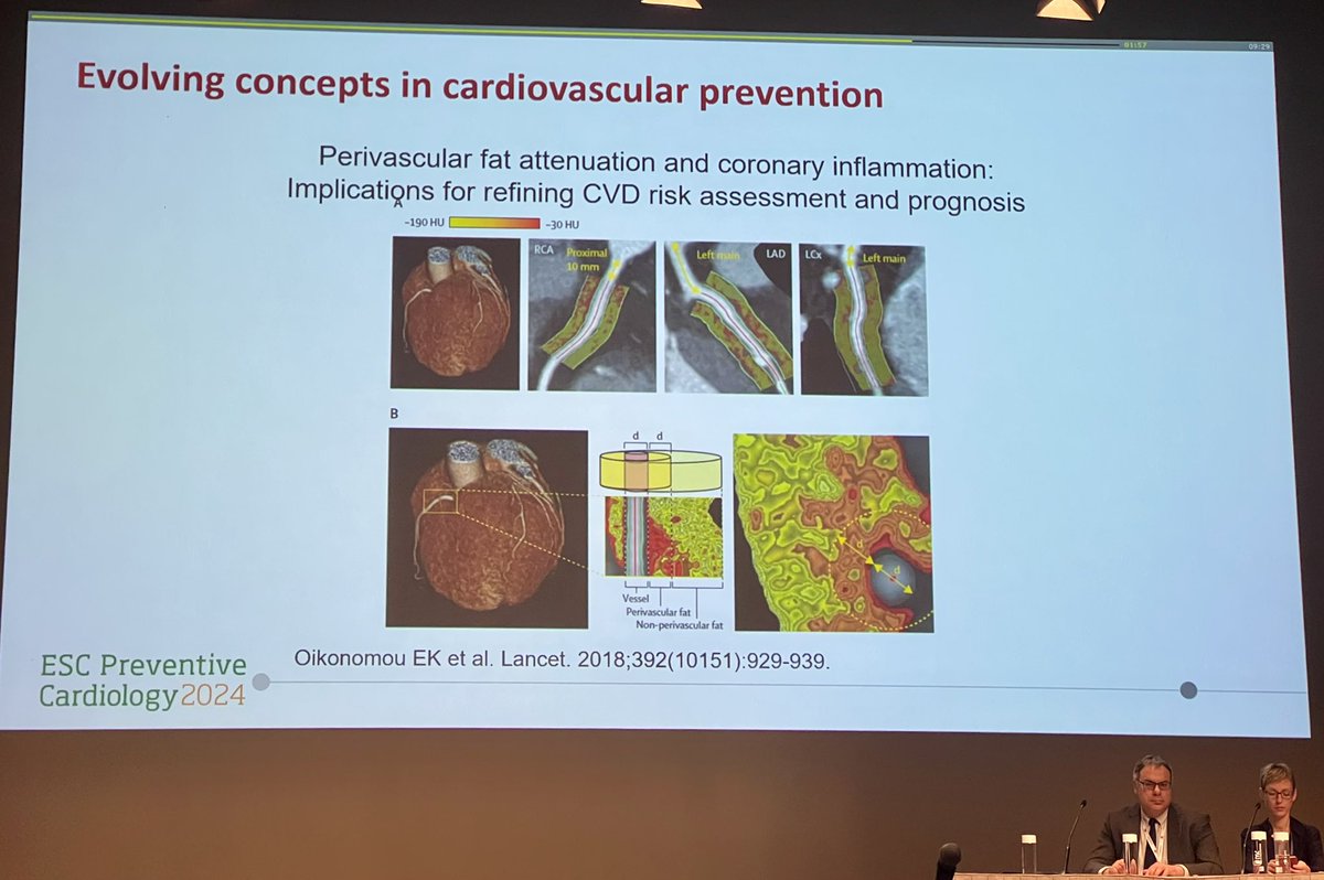 Opening session at #ESCPrev2024 today highlighting LP(a) and new techniques to personalise cardiovascular risk #FAI #prevention @CaristoHeart @SilenceTheraPlc