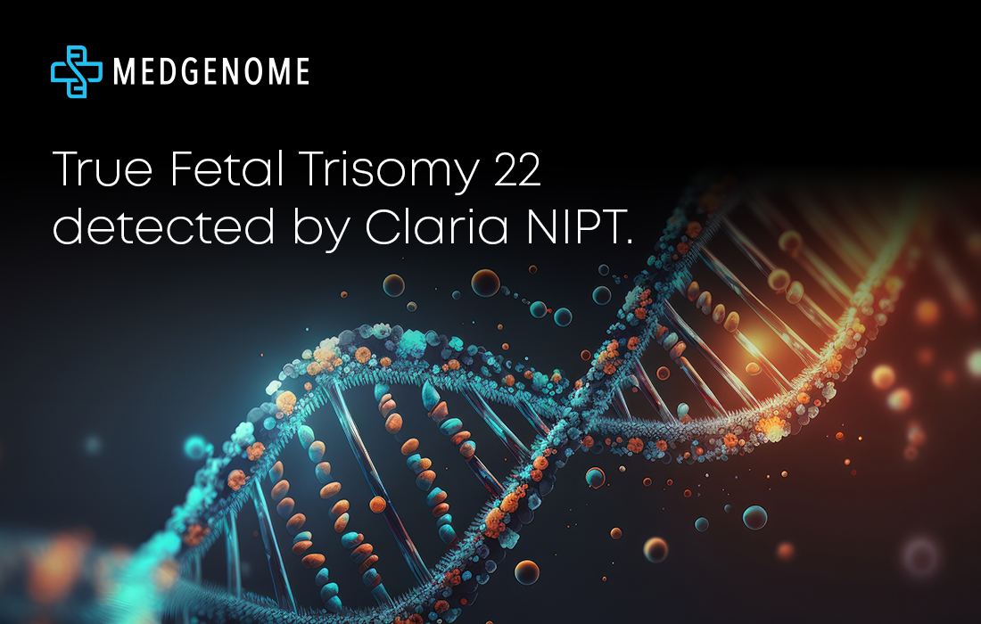 True Fetal Trisomy, a genetic condition, was detected by Claria NIPT in a 26-year-old pregnant woman.
(1/3)