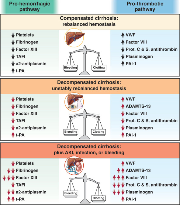 Today's Paper of the Day is on bleeding and thrombotic complications in patients with cirrhosis criticalcarereviews.com/latest-evidenc… Join us to read 1 paper per day and stay up-to-date as we cover the spectrum of critical care across 2024