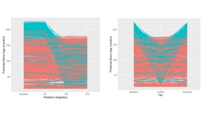 Computational 'stress tests' evaluated robustness of bone age #DL model to simulated real-world image variations doi.org/10.1148/ryai.2… @SamSantomartino @vishwa_parekh @UM2ii #PedsRad #MSKRad #MachineLearning