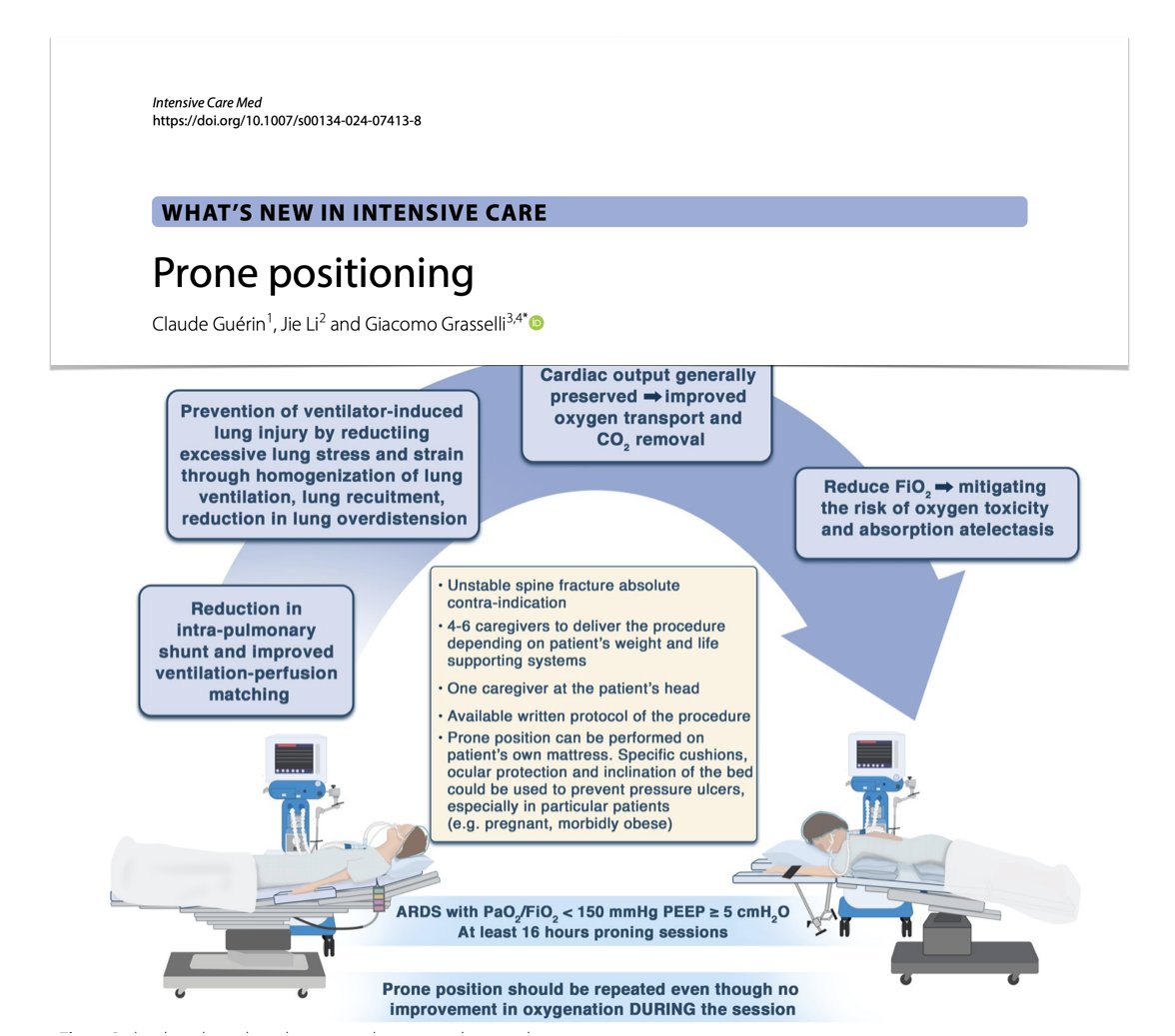 Prone positioning?? Used since 70s to improve oxygenation in patients with #ARDS. Here concise overview 🫁main pathophysiological findings 🫁supporting evidence & practical considerations for use 🫁awake proning in non-intubated pts #FOAMcc on @yourICM 🔓rdcu.be/dFIdO