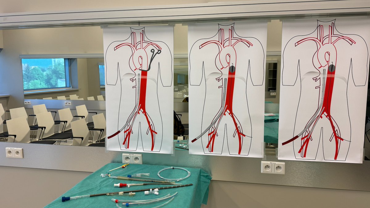 Setting up first @EuroELSO normothermic regional perfusion educational corner at #EuroELSO2024... Are you in Krakow?? Join this #simulation training! Experts from 🇮🇹 🇪🇸 🇬🇧 are going to introduce un(expected) challenges of #NRP #EISOR in #DCD organ donors
Starting at 14:30