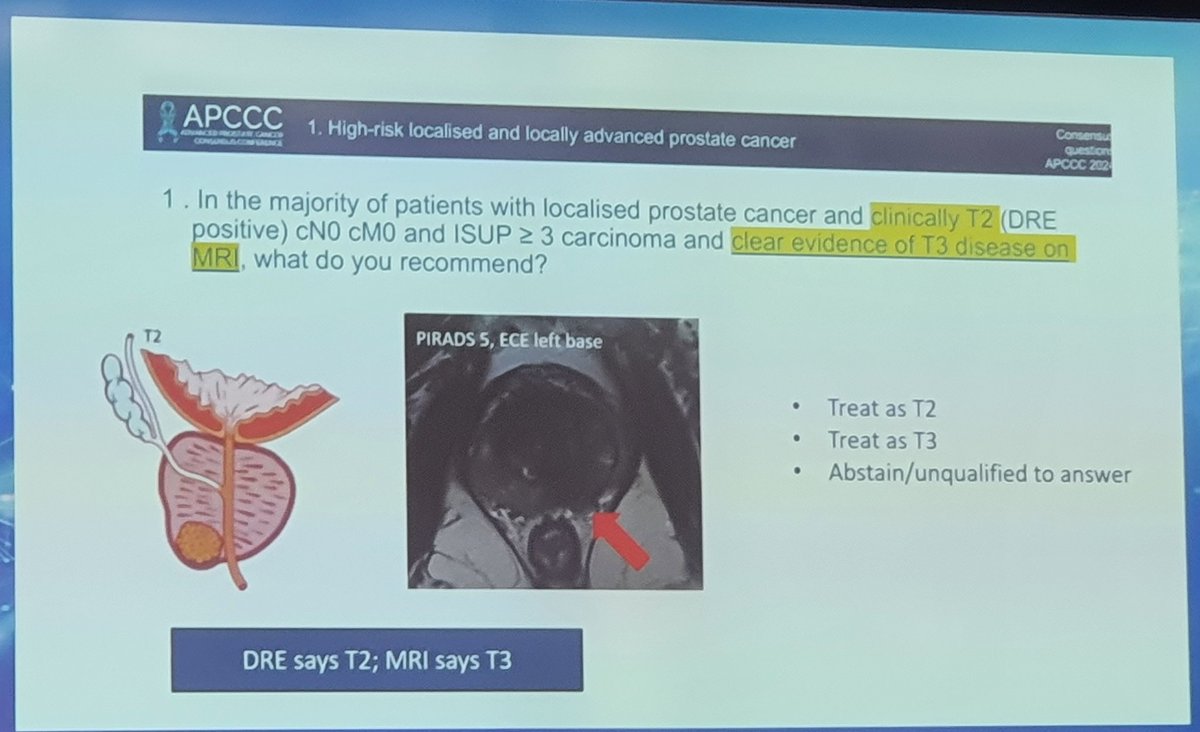 🚀 #APCCC24 Session 1: High-risk & locally advanced prostate cancer. Chairs Neha Vapiwala & Neal Shore will explore the relevance of digital rectal exams in the era of MRI and next-gen imaging. Join the conversation! 💡 @OncoAlert @APCCC_Lugano 🔍 Insightful talk by