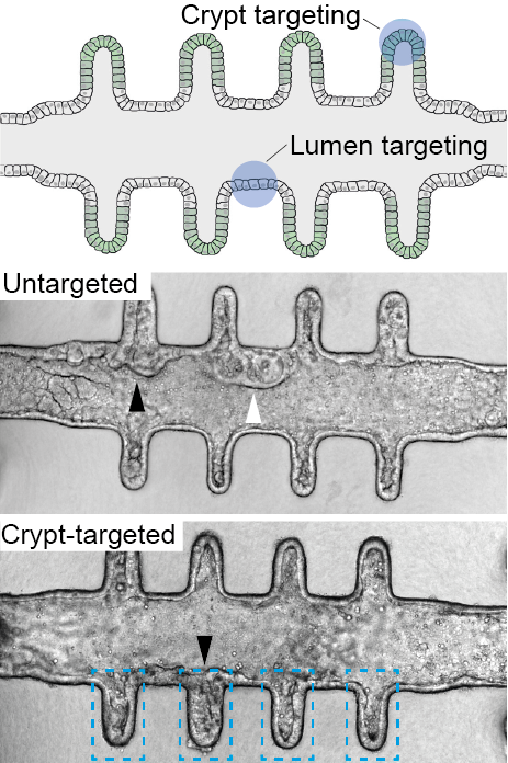 Tumorigenic transformation can be spatiotemporally controlled by directing oncogenic activation through blue-light exposure, and emergent colon tumors can be tracked in real-time with single-cell resolution for several weeks without breaking the culture.