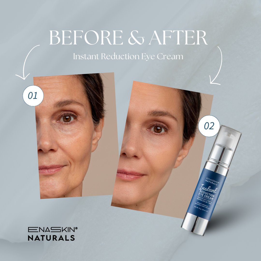 Unlock the magic of refreshed eyes in an instant with Enaskin's Instant Reduction Eye Cream.

Bid farewell to puffiness and dark circles, revealing a brighter, more youthful gaze.

Embrace the power of instant rejuvenation.
.
.
.
#skincare #clearskin #glow #glowup #glowingskin