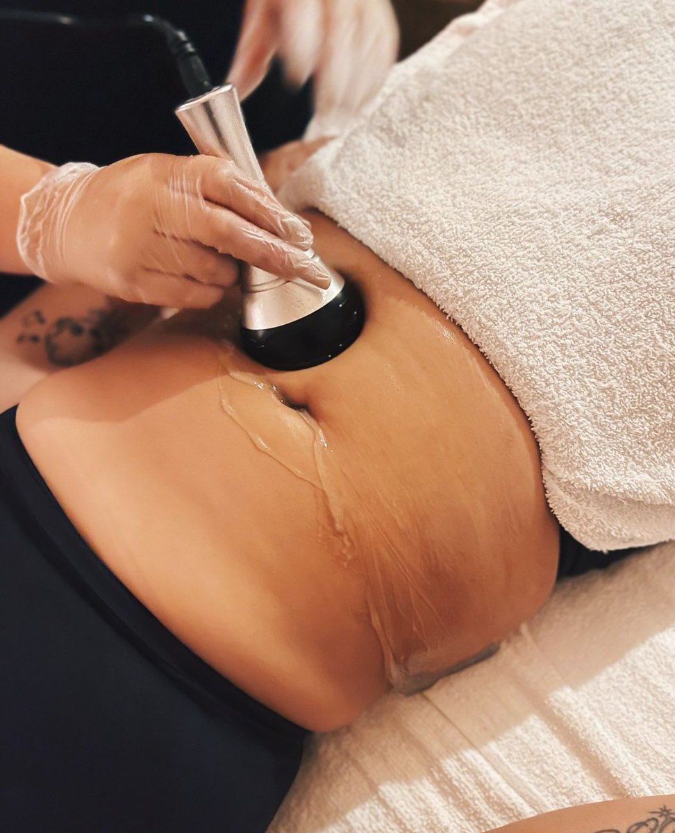 What is Ultrasonic Cavitation❓️A non-invasive pain-free way to remove stubborn fat with low-frequency ultrasound! Simply put, cavitation targets stubborn areas that a healthy lifestyle can't tackle, disrupts the fat & allows you to dispel the fat naturally through SWEATING!⁠