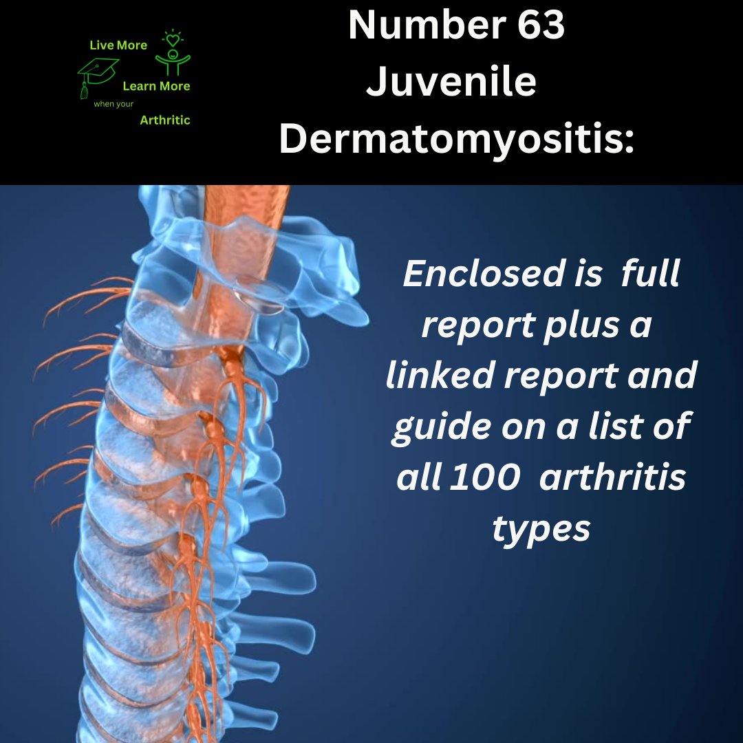 Click here to see the list of 100 different types of arthritis in order of occurrence

#arthritis
#arthritic
#arthriticpain
#arthriticpainrelief
#arthritiscare
#arthritisawareness
#arthritisremission

arthriticare.co/juvenile-derma…